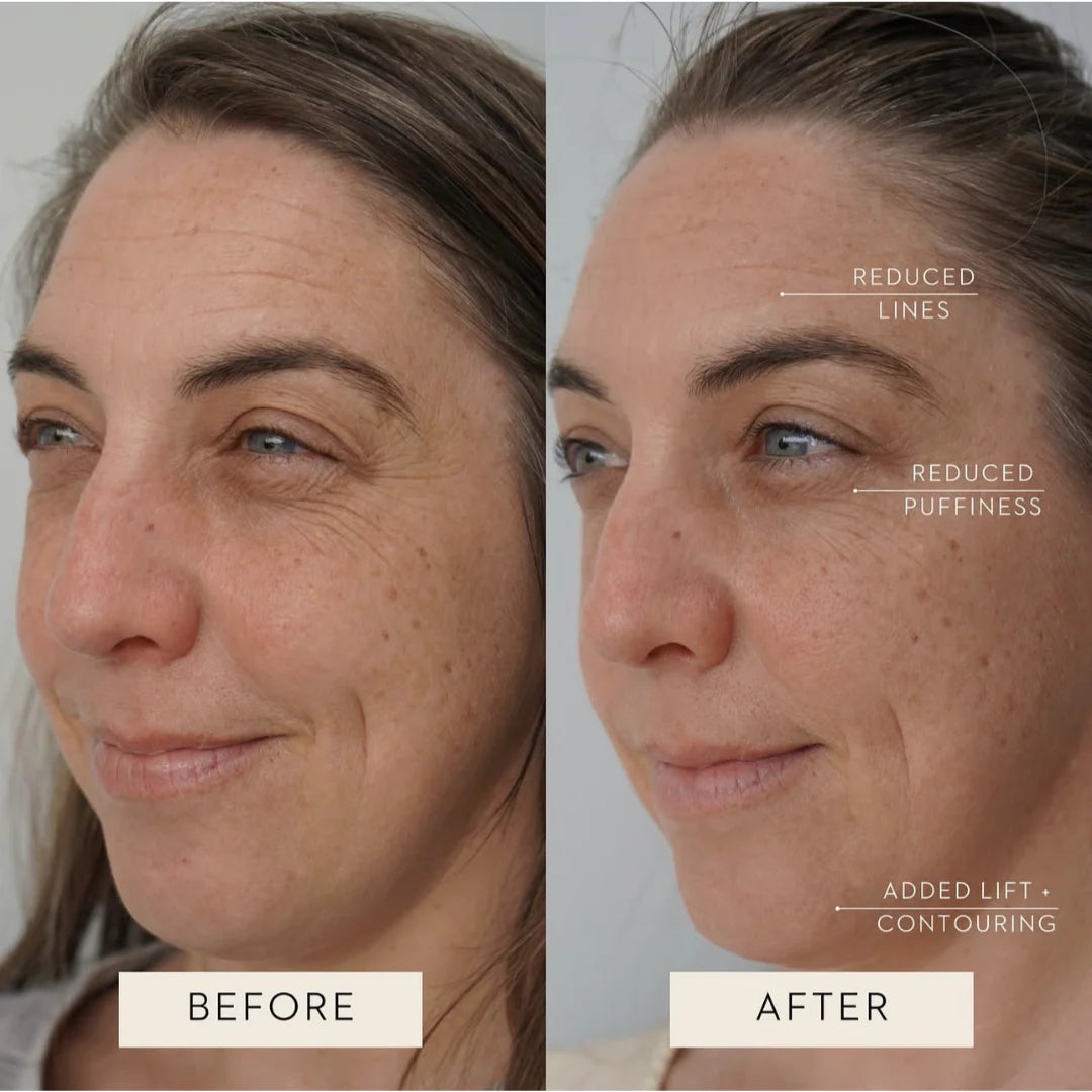 Lymphatic Contour Face Brush